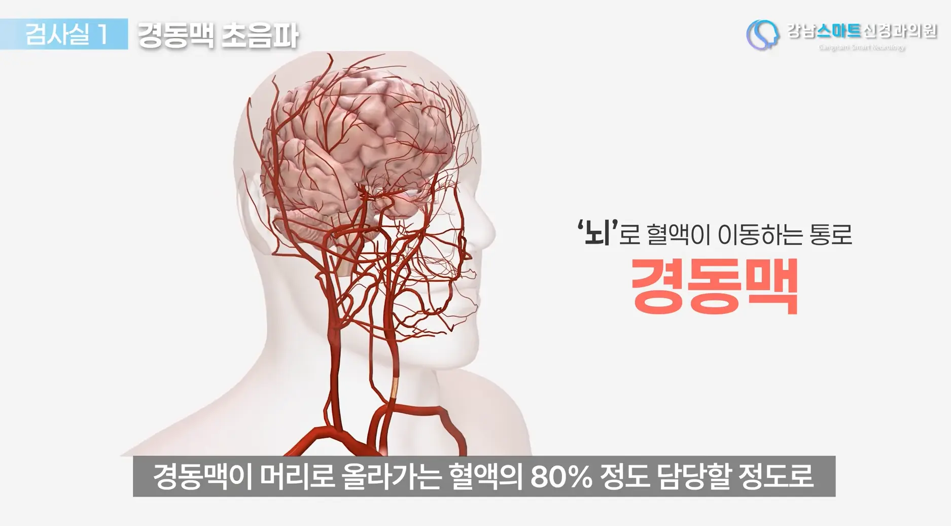 서초 신경과 경동맥 초음파 검사 장비