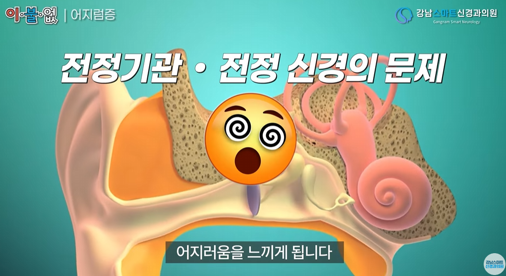메니에르병 원인 전정기관 설명