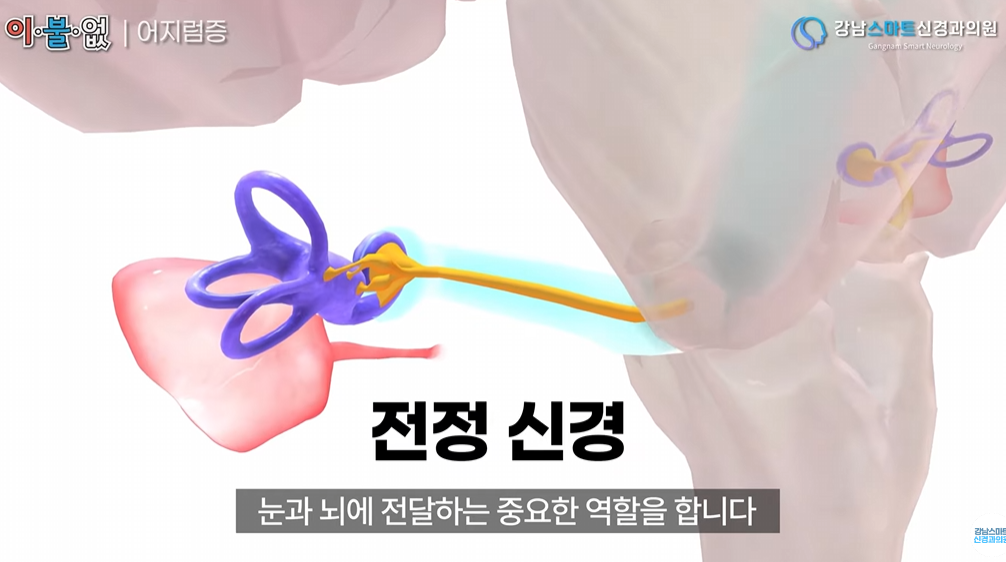 메니에르병 원인 전정 신경 묘사