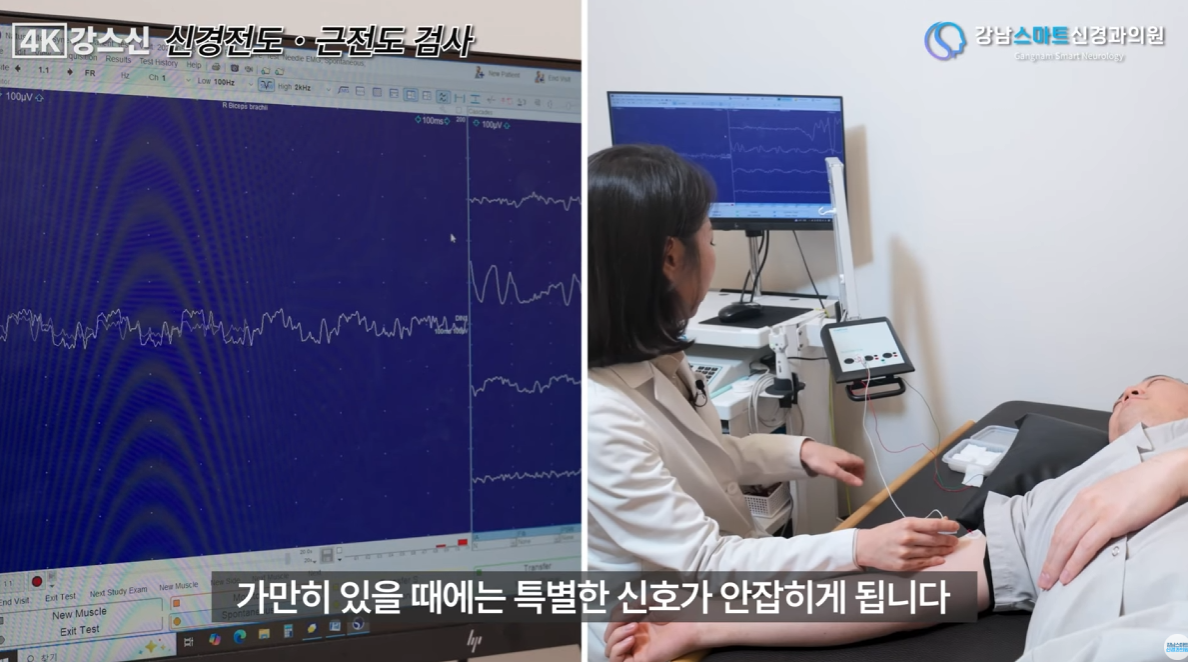 팔다리 저림