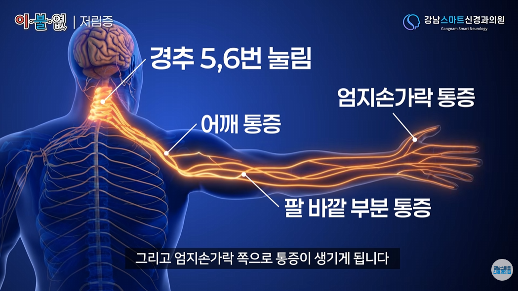 손가락 저림 신경 분석