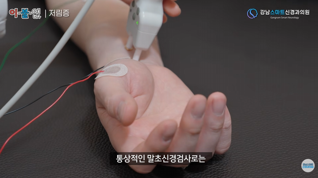 손가락 저림 신경전도 검사