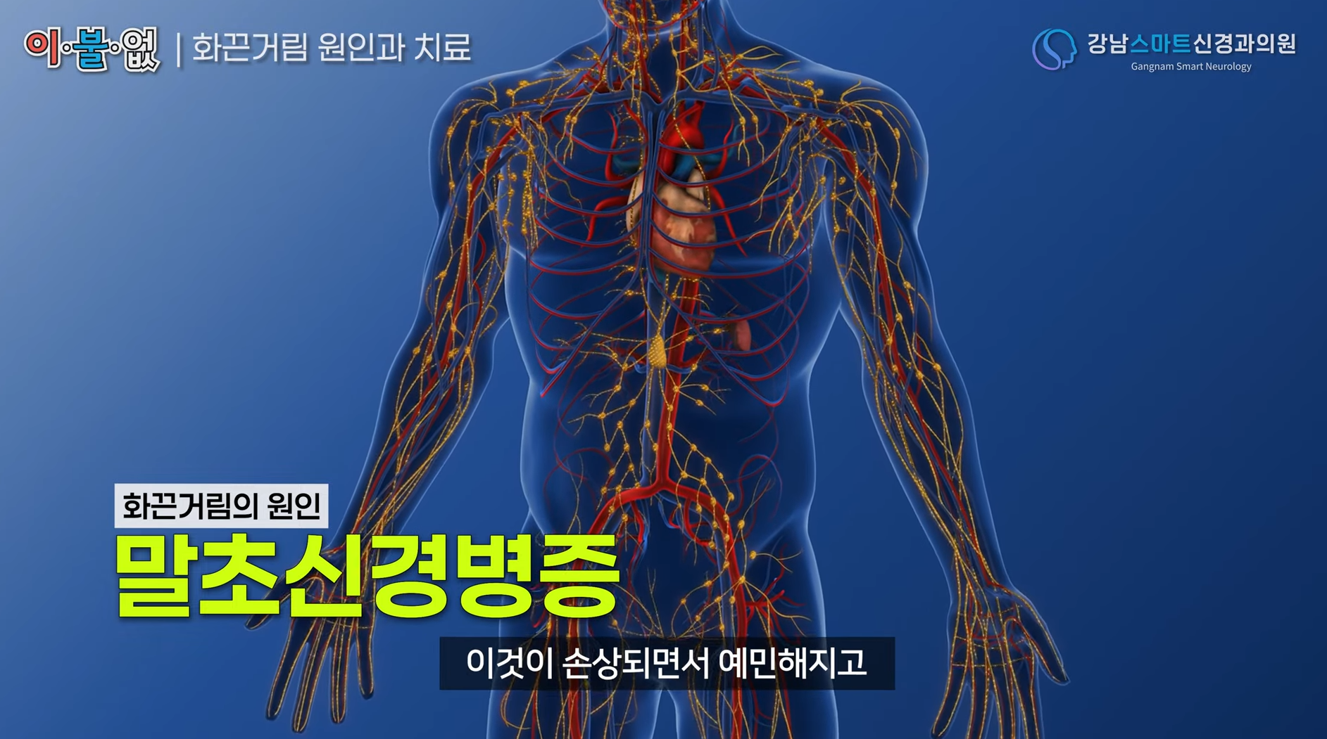 말초신경병증 시각 자료