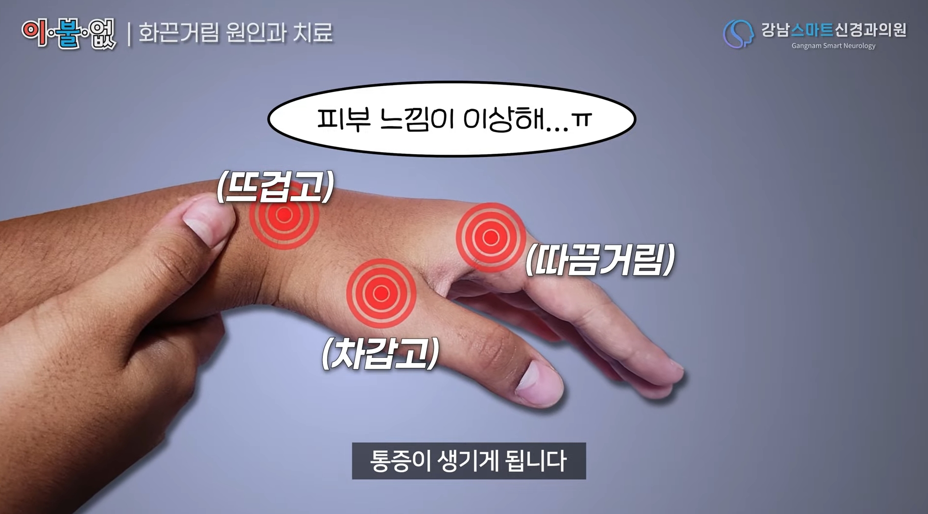 신경전도 검사가 필요한 증상