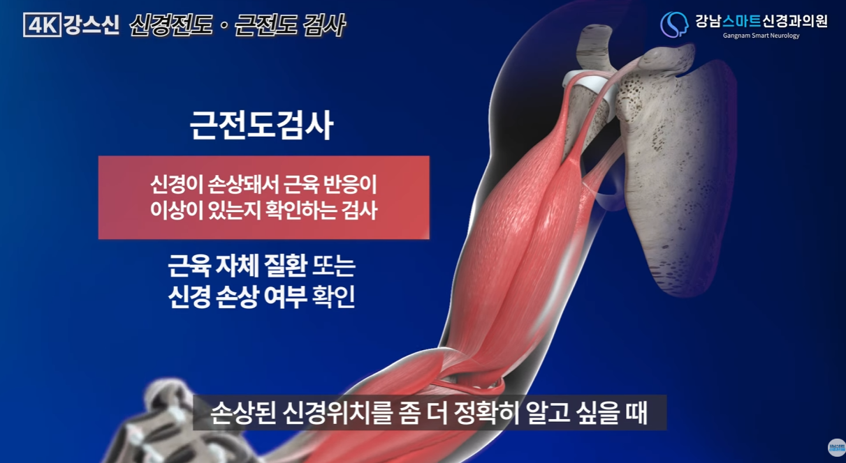 근전도 검사의 정의를 텍스트로 보여주는 사진