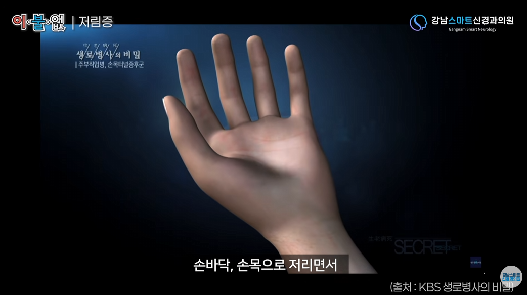 저림 증상을 표현하는 손 일러스트 사진