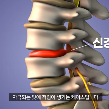 naver_blog_thumb